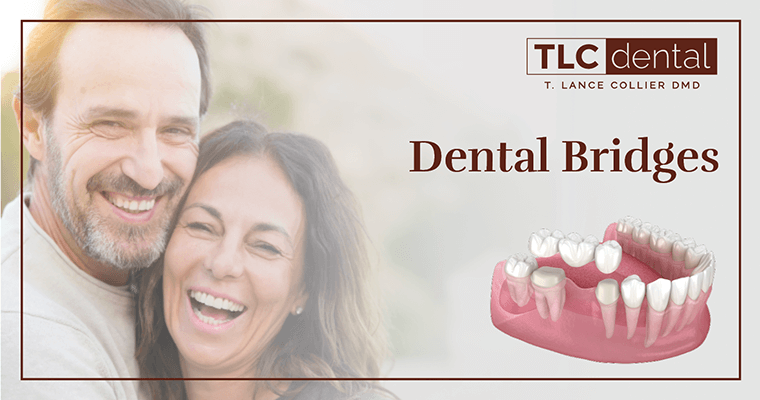 Dental Bridges by TLC Dental
